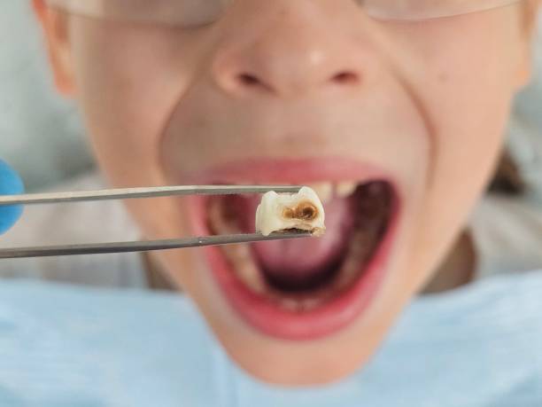 Best Emergency TMJ Treatment in Simonton Lake, IN