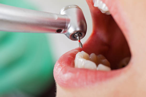 Best Emergency Gum Treatment in Simonton Lake, IN